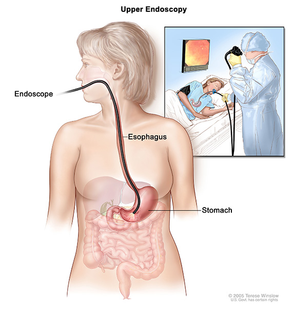 Gastro-endoscopie avec biopsie